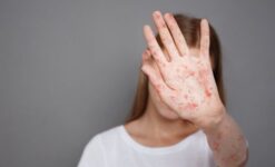 Frengi Belirtileri ve Tedavi Yöntemleri