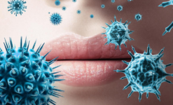 HSV Uçuk Hastalığı Nedir?